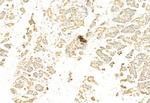 SNAIL Antibody in Immunohistochemistry (Paraffin) (IHC (P))