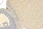 SNAIL Antibody in Immunohistochemistry (Paraffin) (IHC (P))