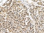 SON Antibody in Immunohistochemistry (Paraffin) (IHC (P))