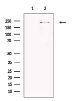 SORL1 Antibody in Western Blot (WB)