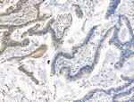 STATH Antibody in Immunohistochemistry (Paraffin) (IHC (P))