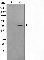 STEAP3 Antibody in Western Blot (WB)