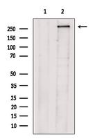 TACC2 Antibody in Western Blot (WB)