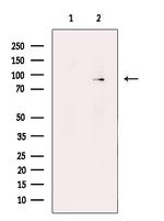 TAP1 Antibody in Western Blot (WB)