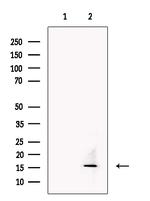 TECK Antibody in Western Blot (WB)