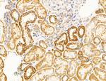 VDAC2 Antibody in Immunohistochemistry (Paraffin) (IHC (P))