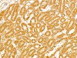 VDAC2 Antibody in Immunohistochemistry (Paraffin) (IHC (P))