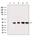 VDAC2 Antibody in Western Blot (WB)