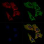 Wnt10B Antibody in Immunocytochemistry (ICC/IF)