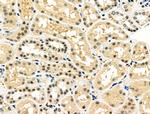 WT1 Antibody in Immunohistochemistry (Paraffin) (IHC (P))