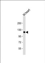 SCYL2 Antibody in Western Blot (WB)