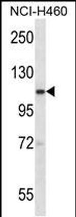 SCYL2 Antibody in Western Blot (WB)