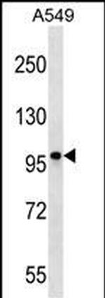 CCDC141 Antibody in Western Blot (WB)