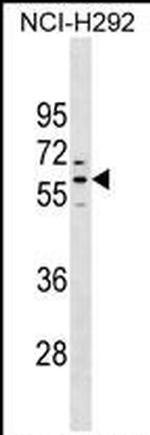 PRAMEF1 Antibody in Western Blot (WB)