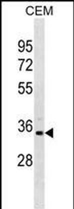 PRPS1L1 Antibody in Western Blot (WB)