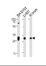 ANP32E Antibody in Western Blot (WB)