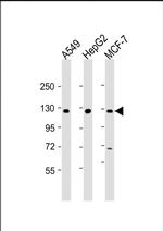 KLB Antibody in Western Blot (WB)