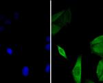 GABARAPL2 Antibody in Immunocytochemistry (ICC/IF)
