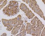 ITCH Antibody in Immunohistochemistry (Paraffin) (IHC (P))