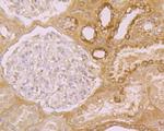 Folate Receptor alpha Antibody in Immunohistochemistry (Paraffin) (IHC (P))