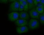 ENT1 Antibody in Immunocytochemistry (ICC/IF)