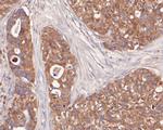 ENT1 Antibody in Immunohistochemistry (Paraffin) (IHC (P))