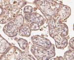 ATG4A Antibody in Immunohistochemistry (Paraffin) (IHC (P))