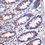 FGF2 Antibody in Immunohistochemistry (Paraffin) (IHC (P))