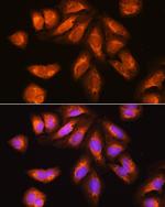 RRP4 Antibody in Immunocytochemistry (ICC/IF)