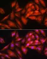 RRP4 Antibody in Immunocytochemistry (ICC/IF)