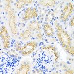 SRPX Antibody in Immunohistochemistry (Paraffin) (IHC (P))