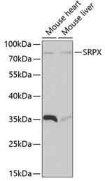 SRPX Antibody in Western Blot (WB)