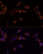 PRDX3 Antibody in Immunocytochemistry (ICC/IF)