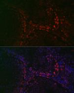 DAZL Antibody in Immunohistochemistry (Paraffin) (IHC (P))