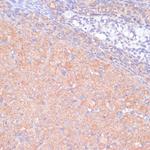 KANK2 Antibody in Immunohistochemistry (Paraffin) (IHC (P))