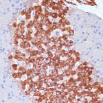 KANK2 Antibody in Immunohistochemistry (Paraffin) (IHC (P))