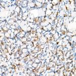 NALP1 Antibody in Immunohistochemistry (Paraffin) (IHC (P))