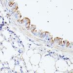 HSPB11 Antibody in Immunohistochemistry (Paraffin) (IHC (P))