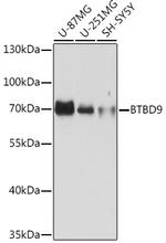 BTBD9 Antibody in Western Blot (WB)