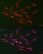 RAI16 Antibody in Immunocytochemistry (ICC/IF)