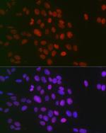 H3R26me2s Antibody in Immunocytochemistry (ICC/IF)