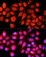 RT28 Antibody in Immunocytochemistry (ICC/IF)