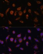 HIF1AN Antibody in Immunocytochemistry (ICC/IF)