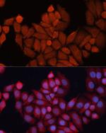 HSP40 Antibody in Immunocytochemistry (ICC/IF)