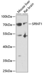 HAI-1 Antibody in Western Blot (WB)