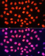 H3K64me3 Antibody in Immunocytochemistry (ICC/IF)