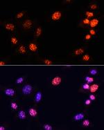 H3K64me3 Antibody in Immunocytochemistry (ICC/IF)