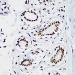 H3K64me3 Antibody in Immunohistochemistry (Paraffin) (IHC (P))