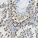 METTL14 Antibody in Immunohistochemistry (Paraffin) (IHC (P))