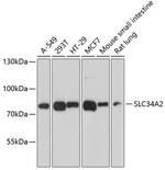 SLC34A2 Antibody in Western Blot (WB)